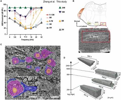 Volume electron microscopy reveals age-related circuit remodeling in the auditory brainstem